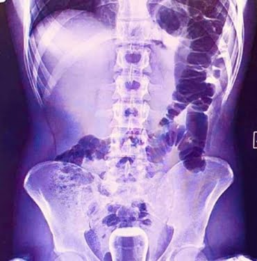 QahLzfPUCxUiZAdIvbQ1OS7ysHgF7TMfqBl8iDjt