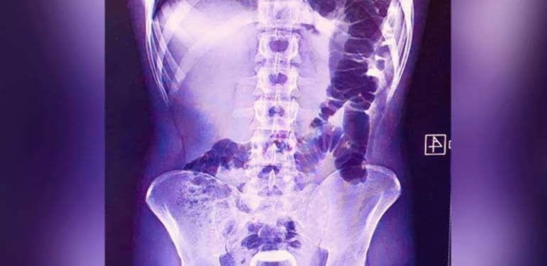 QahLzfPUCxUiZAdIvbQ1OS7ysHgF7TMfqBl8iDjt