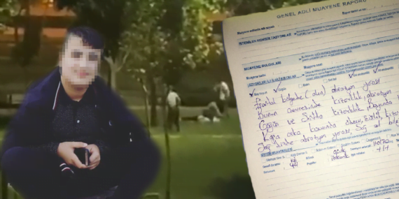 Darp Edilen Çocuğun Babası Konuştu: Gözümün Önünde Oğlumu Linç Ettiler