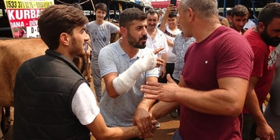 Kurbanlık pazarında el sıkışmaktan kolu çatladı