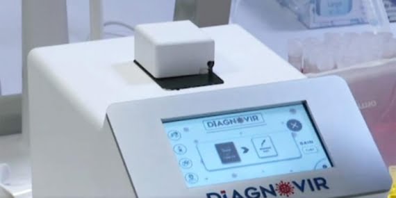 10 saniyede Covid-19 testi sonucunu belirliyor: Seri üretimine başlandı