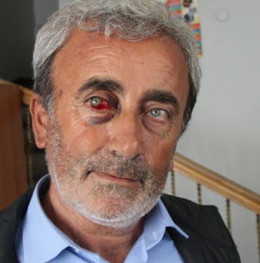 karabas-iskence-suc-duyurusu1