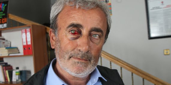 Karabaş 3. kez gözaltına alındı