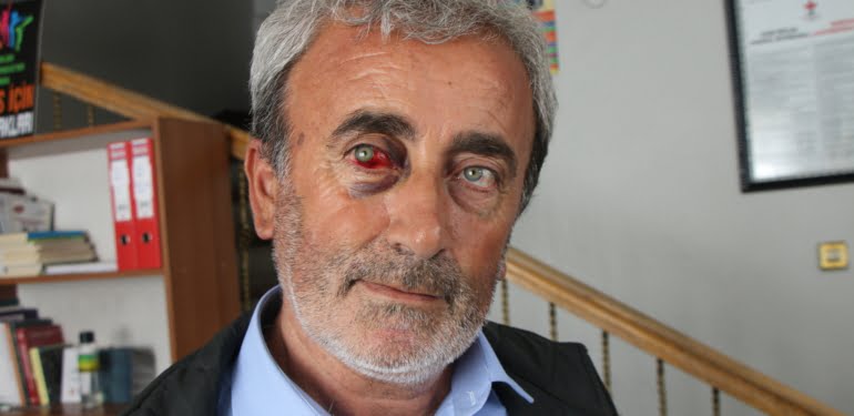 karabas-iskence-suc-duyurusu1