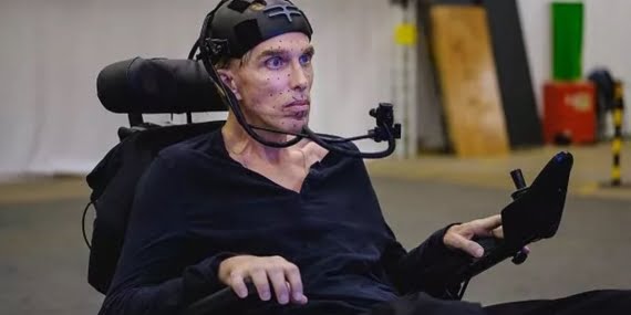 Dünyanın ilk siborg’u hayatını kaybetti