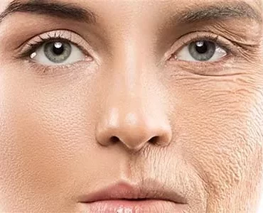 ce60d58f1daf4108a7b4572f60ca7555