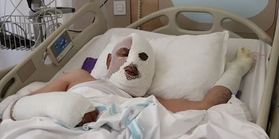 Tıkalı lavaboyu açmak isterken vücudunda yanıklar oluştu