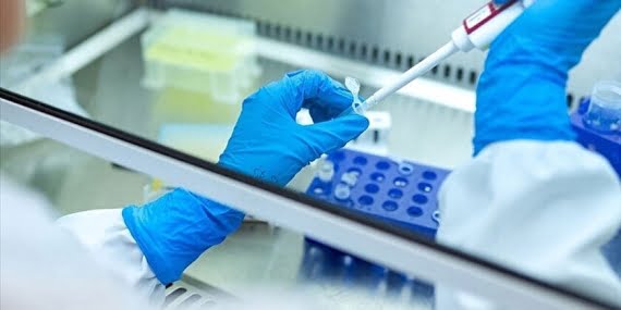 Sudan’da ilk maymun çiçeği vakası tespit edildi