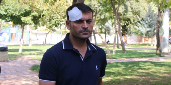 Kastamonu’daki saldırıdan yaralı olarak kurtulan Batmanlı Oran konuştu: Kendini kurtarmak, suçunu örtmek için ‘çamaşır’ yalanını ortaya attı