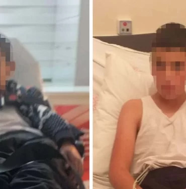 kuduz-kopek-tarafindan-isirilan-cocuk