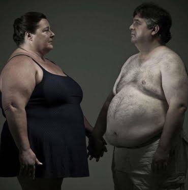 obezite-neden-olur-min