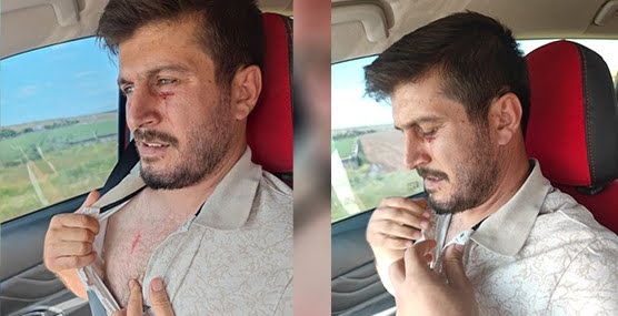 Bismil’de bir kişi polis tarafından darp edildiğini iddia etti