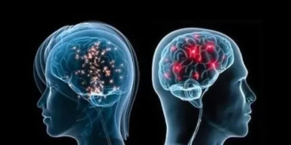 Felçli adam beyin implantı sayesinde 12 yıl sonra ilk defa yürüdü