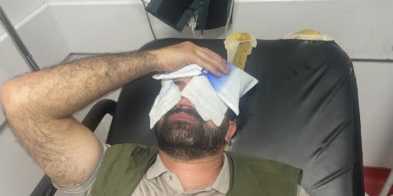 HDP’li yönetici darp edildi