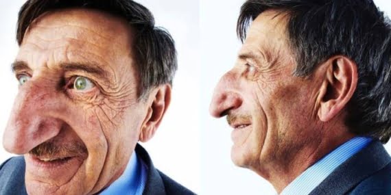 Dünyanın en uzun burunlu insanı vefat etti