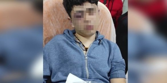 Çocuğa işkence eden 3 polisin tahliyesine Diyarbakır Barosu’ndan tepki