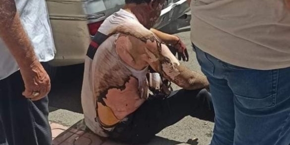 Diyarbakır’da trafo şalteri patladı: 2 personel yaralandı