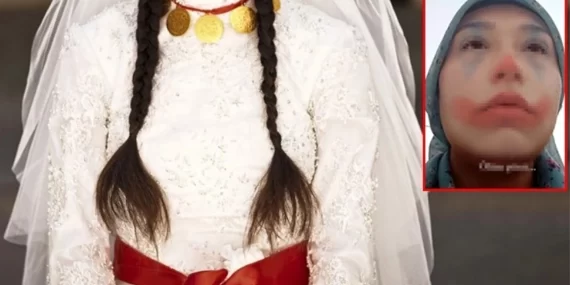 Niğde’de 15 yaşındaki çocuğun zorla ‘evlendirilmesi’: Anne, baba ve evlendirileceği erkek gözaltında