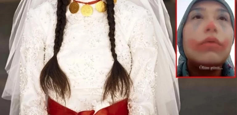 cocuk-gelin-skandali-bakanliktan-aciklama