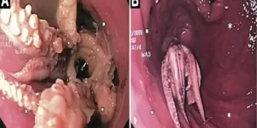 odatv_image_97__77910c454b2749