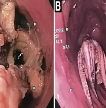 odatv_image_97__77910c454b2749