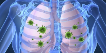 verem-hastaligi-hakkinda-bilgi-1024x597