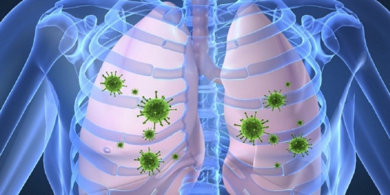 Verem hastası vakaları: Alım gücünün düşmesi nedeniyle insanlar beslenemiyor