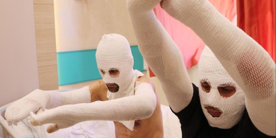 Bir gaz doldururken diğer sigara yaktı. İkisi de hastanede