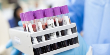 d5299007265e30476cc2a6a6c149088c