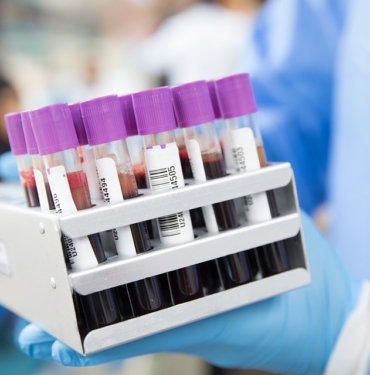 d5299007265e30476cc2a6a6c149088c