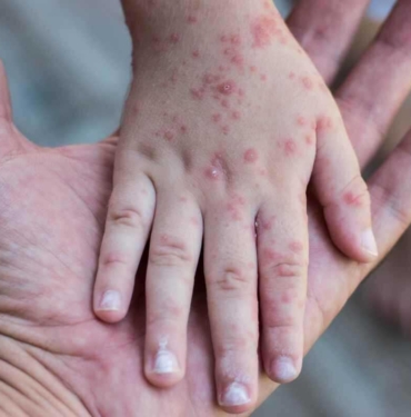 kizamikdokuntusjpg_d113