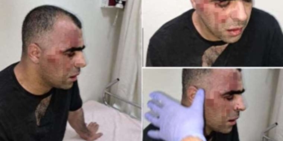 Gazeteci Sinan Aygül’ü darp eden saldırganlardan biri Aygül hakkında uzaklaştırma kararı aldı