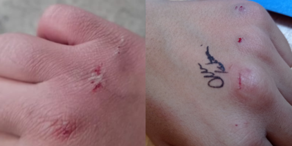 Ebeveynler bu oyuna dikkat: Öğrencilerin kanlı oyunu okullarda giderek yayılıyor