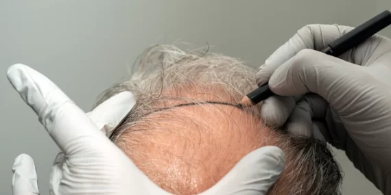 2023’te sağlık turizminden 2,3 milyar dolarlık gelir elde edildi