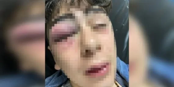 14 yaşındaki çocuğa polis işkencesi davasında karar