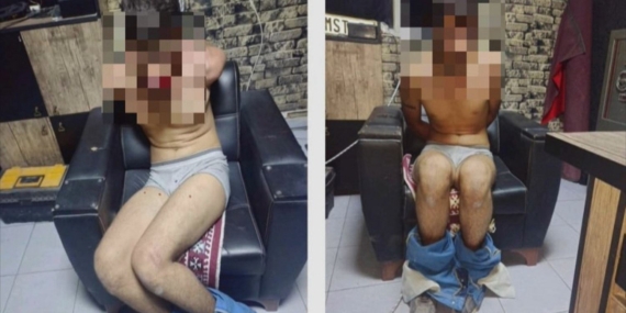 Maaşını istediği için işkence gören Urfalı genç adalet arıyor: Elektrik verdiler, dişlerini kerpetenle çektiler