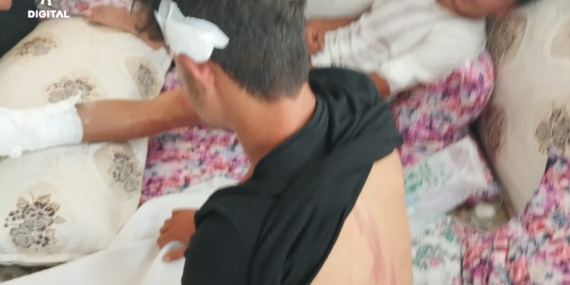 Muğla’da Kürt işçilere saldırı: Ölesiye dövüldüler