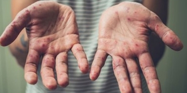 s-2ae37c392024b74ff94cae966f1b371e0e5d2276