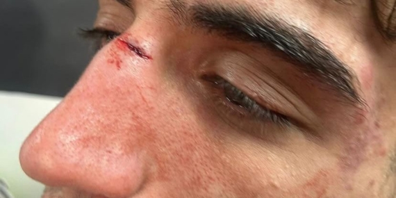 Batman Kayrasporlu oyunculara saldırı