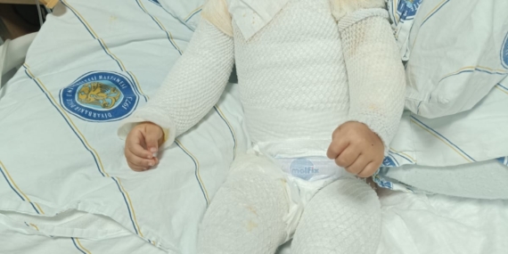 Batman’da kaynar su kazası: Aile yardım bekliyor