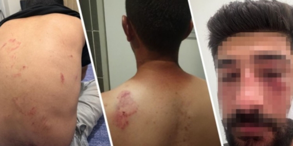 Kürtçe konuşan aileye ırkçı saldırı: 1 ağır yaralı… Milletvekilinden sert tepki