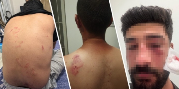 Irkçı terörizmin son durağı Mersin! Bebek de dinlemediler…