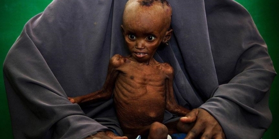 BM: Somali’de milyonlarca kişi açlık krizi riskiyle karşı karşıya