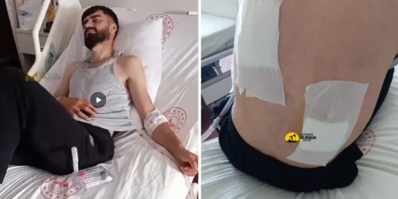 Ordu’da çıkan tartışmada Batmanlı mevsimlik işçi bıçaklandı